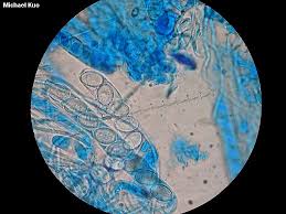 Attēlu rezultāti vaicājumam “Scutellinia scutellata”