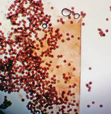 Attēlu rezultāti vaicājumam “Diderma roanense spores”