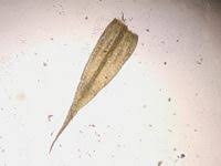 Attēlu rezultāti vaicājumam “Sciuro-hypnum reflexum sporophyte”