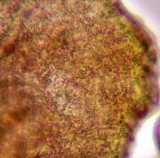 Attēlu rezultāti vaicājumam “Gulielmina vermicularis”