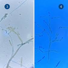 Attēlu rezultāti vaicājumam “Diderma subviridifuscum var. macrospora* spores”