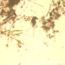 Attēlu rezultāti vaicājumam “Bulbochaete mirabilis”