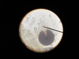 Attēlu rezultāti vaicājumam “Sawadaea tulasnei”