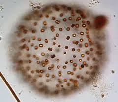 Attēlu rezultāti vaicājumam “Gloeocapsa rupestris”