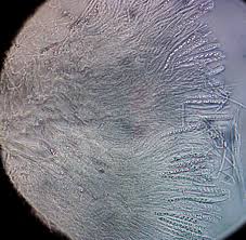 Attēlu rezultāti vaicājumam “Octospora splachnophila spores”