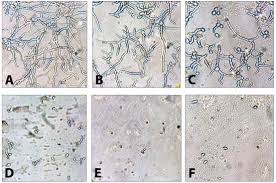 Attēlu rezultāti vaicājumam “Trichia botrytis spores”