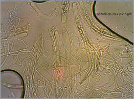 Attēlu rezultāti vaicājumam “Stictis”