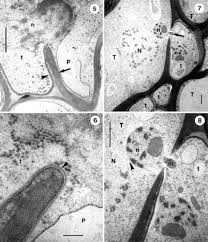 Attēlu rezultāti vaicājumam “Tranzschelia pruni-spinosae spores”