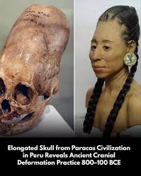Image result for elongated skulls