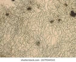 Attēlu rezultāti vaicājumam “Nostoc pruniforme cells”