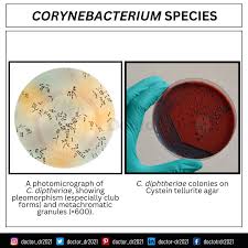 Attēlu rezultāti vaicājumam “Sanionia uncinata  sporophyte”