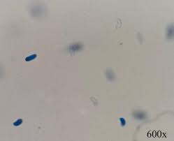 Attēlu rezultāti vaicājumam “Dacrymyces chrysospermus spores”
