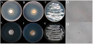 Attēlu rezultāti vaicājumam “Anomodon attenuatus sporophyte”
