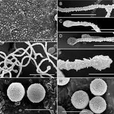Attēlu rezultāti vaicājumam “Physarum bryocorticola spores”