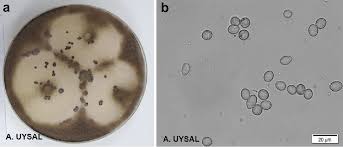 Attēlu rezultāti vaicājumam “Trichia botrytis var. cerifera spores”
