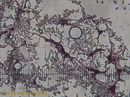 Attēlu rezultāti vaicājumam “Cribraria purpurea”