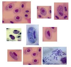 Attēlu rezultāti vaicājumam “Lycogala botrydium plasmodium”