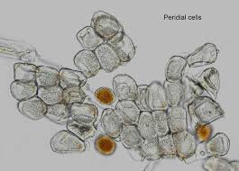 Attēlu rezultāti vaicājumam “Puccinia poarum”