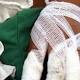 A 10 aument&oacute; el n&uacute;mero de personas quemadas en Norte de ... - RCN Radio (blog)
