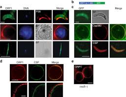 Attēlu rezultāti vaicājumam “Lignydium muscorum plasmodium”