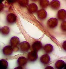 Attēlu rezultāti vaicājumam “Lamproderma puncticulatum macro”