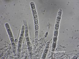 Attēlu rezultāti vaicājumam “Acrocordia gemmata”