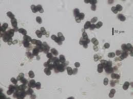 Attēlu rezultāti vaicājumam “Calicium adspersum”