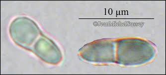 Attēlu rezultāti vaicājumam “Arthonia spadicea”