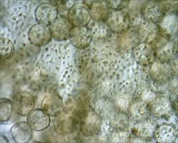 Attēlu rezultāti vaicājumam “Arcyria affinis”