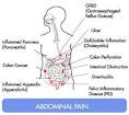 <b>Abdominal Pain</b> Symptoms You