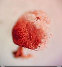 Attēlu rezultāti vaicājumam “Cribraria rubiginosa macro”