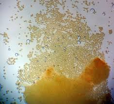 Attēlu rezultāti vaicājumam “Enteridium liceoides”