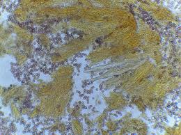 Attēlu rezultāti vaicājumam “Badhamia capsulifera var. arborea sessile”