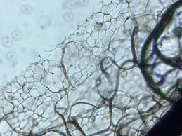 Attēlu rezultāti vaicājumam “Stemonitis lignicola spores”