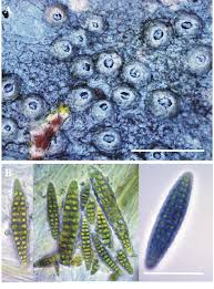 Attēlu rezultāti vaicājumam “Thelotrema lepadinum”