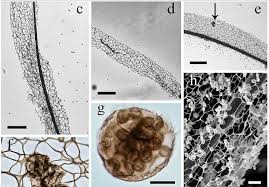 Attēlu rezultāti vaicājumam “Stemonitis axifera var. smithii spores”