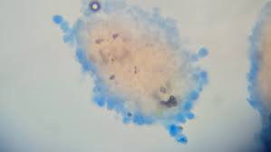 Attēlu rezultāti vaicājumam “Erythricium aurantiacum”