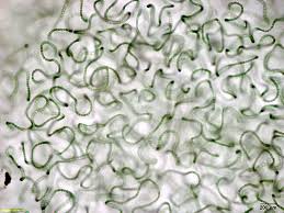 Attēlu rezultāti vaicājumam “Nostoc pruniforme cells”