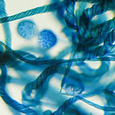 Attēlu rezultāti vaicājumam “Trichia crateriformis stalked”