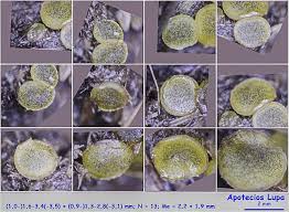 Attēlu rezultāti vaicājumam “Ascobolus furfuraceus”