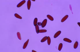 Attēlu rezultāti vaicājumam “Dianema nivale spores”