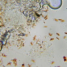Attēlu rezultāti vaicājumam “Calicium salicinum”
