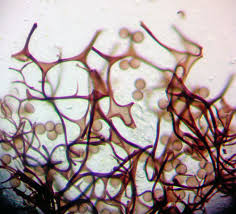 Attēlu rezultāti vaicājumam “Stemonitopsis subcaespitosa”