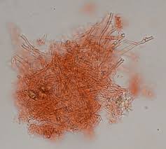 Attēlu rezultāti vaicājumam “Gloeoporus pannocinctus”