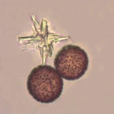 Attēlu rezultāti vaicājumam “Physarum leucopus spores”