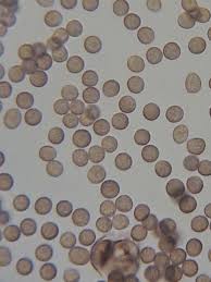 Attēlu rezultāti vaicājumam “Stemonitis fusca young”