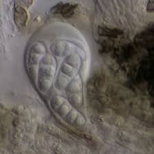 Attēlu rezultāti vaicājumam “Arthonia byssacea”