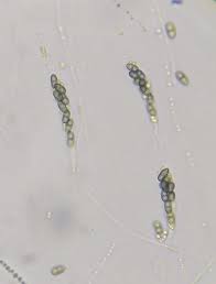 Attēlu rezultāti vaicājumam “Lindbladia tubulina spores”