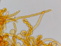 Attēlu rezultāti vaicājumam “Badhamiopsis praetermissa macro”