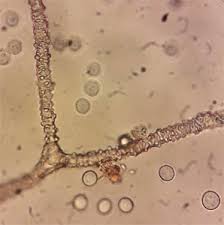 Attēlu rezultāti vaicājumam “Lycogala cf. fossiculatum”
